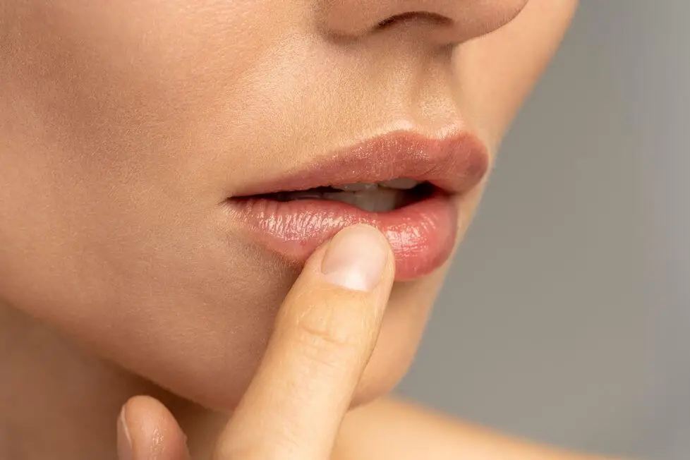 pękające usta - jak poradzić sobie z pękającymi ustami