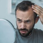 Jak poradzić sobie z łysieniem – poradnik