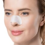 Plastyka nosa - wszystko co musisz o tym wiedzieć