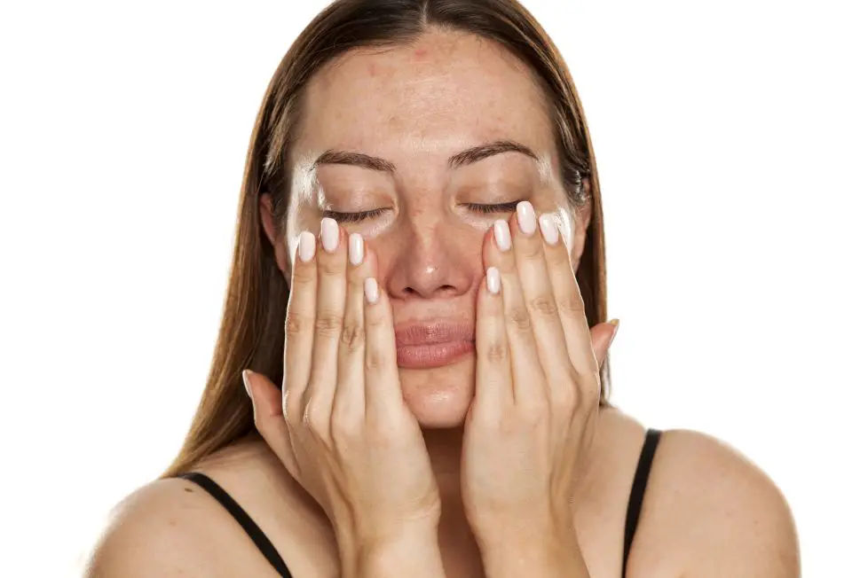Ciazowa maska–czym jest melasma i jak z nia walczyc Melasma–leczenie