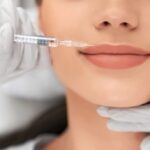 Modelowanie ust z uzyciem kwasu hialuronowego – bezpieczenstwo i skutecznosc