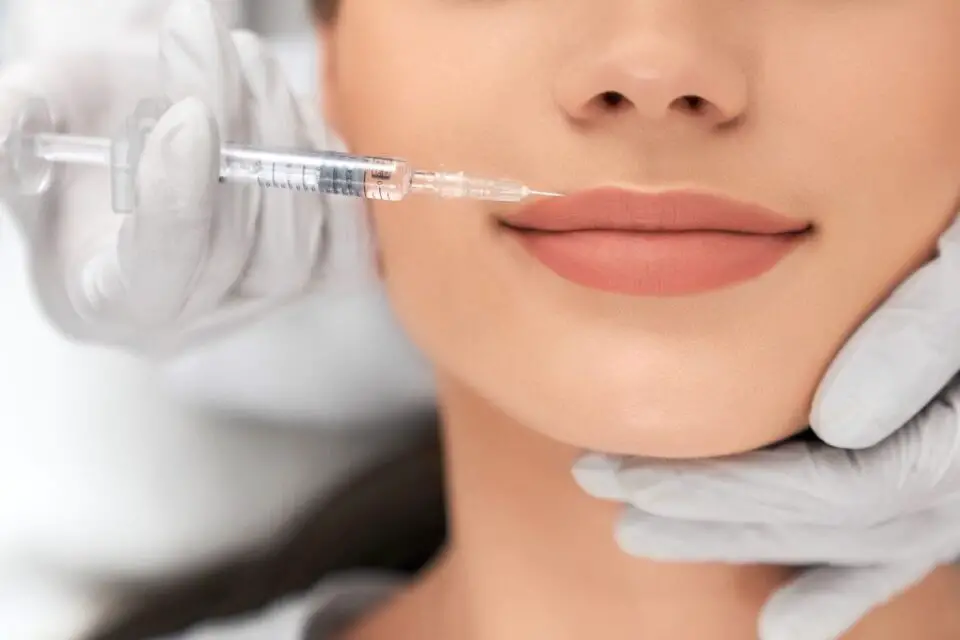 Modelowanie ust z uzyciem kwasu hialuronowego – bezpieczenstwo i skutecznosc